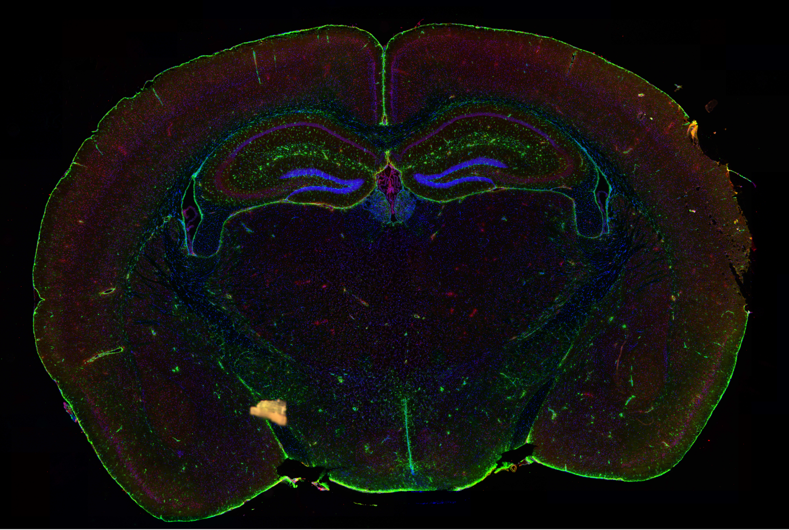Brain Tissue 3채널 형광 이미지
