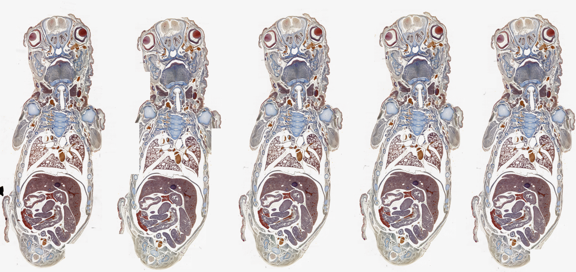 Mouse embryo × 5 Serial section