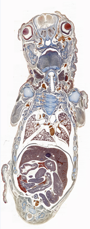 Mouse embryo 단일 샘플
