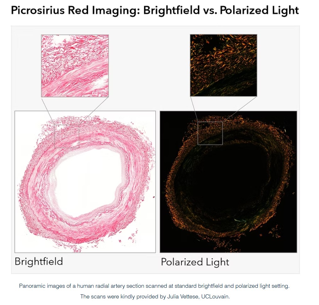 Picrosirius Red 콜라겐 편광 이미지